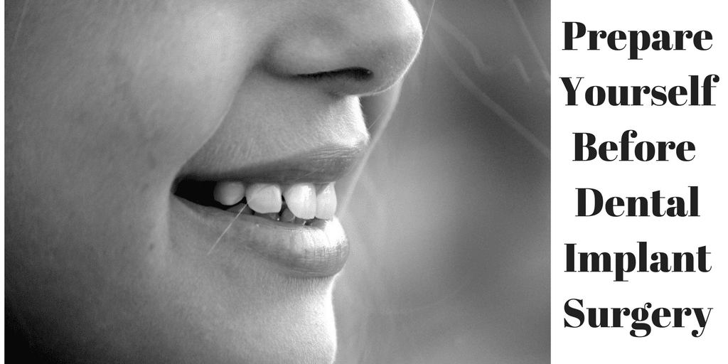Prepare Yourself Dental Implant Surgery