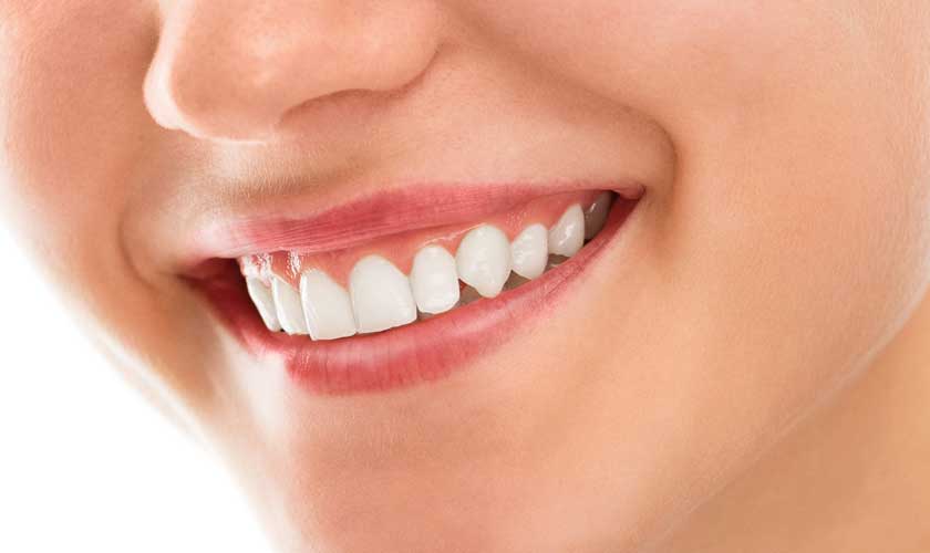 Teeth Whitening - Advanced Family Dentistry