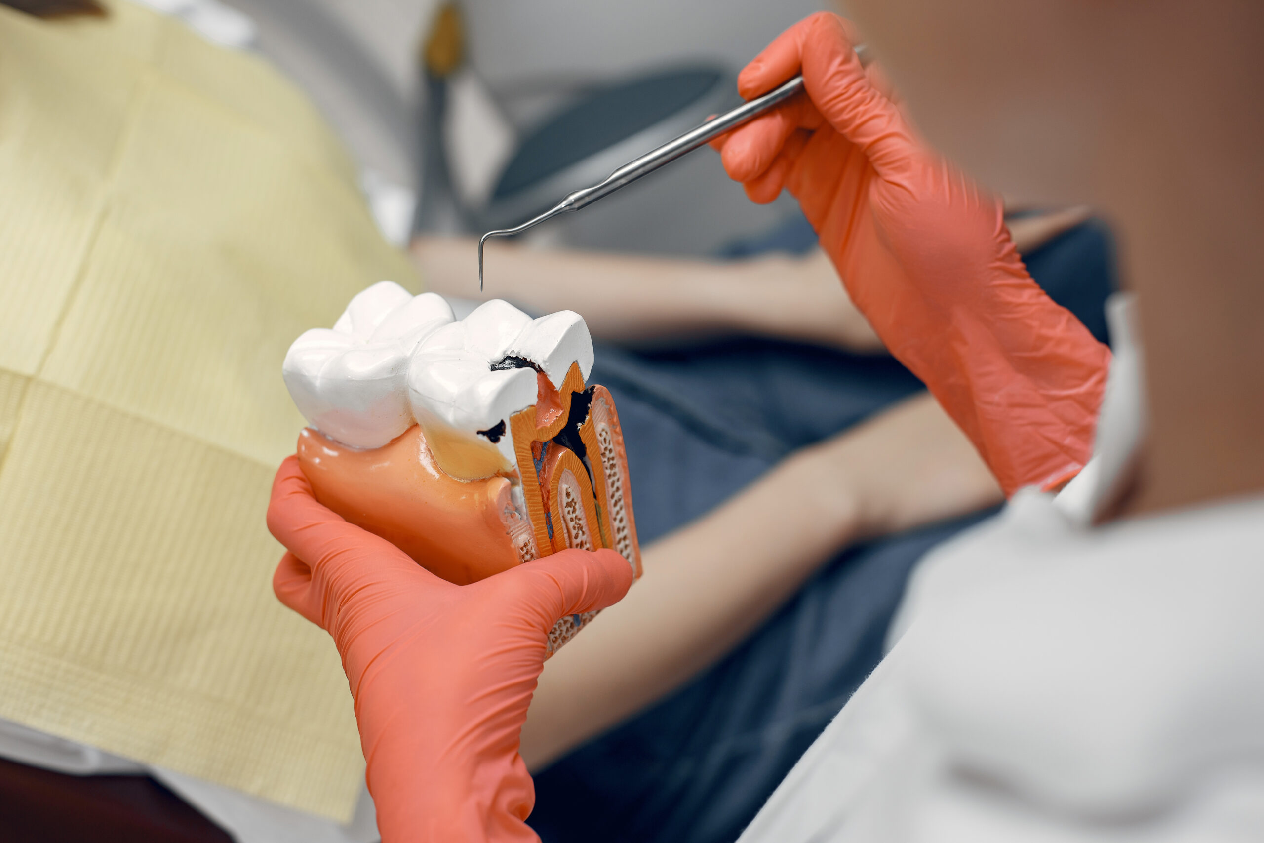 Wisdom Tooth Extraction - Advanced Family Dentistry Of Nashua