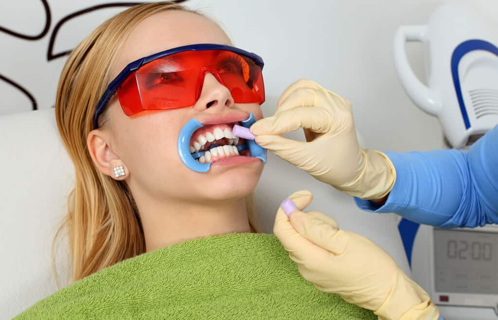 teeth whitening in Nashua, Nh | Advanced Family dentist nashua