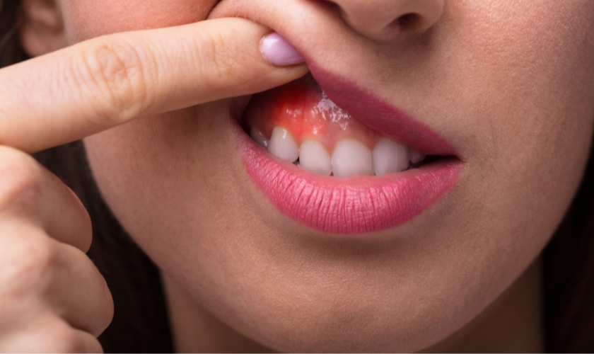 What Is The Best Thing To Do For Gum Disease?
