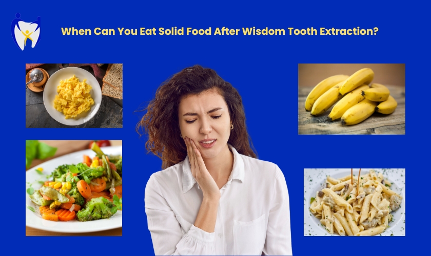 When Can You Eat Solid Food After Wisdom Tooth Extraction