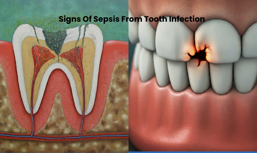 Signs of sepsis from tooth infection - Advanced Family Dentistry Nashua