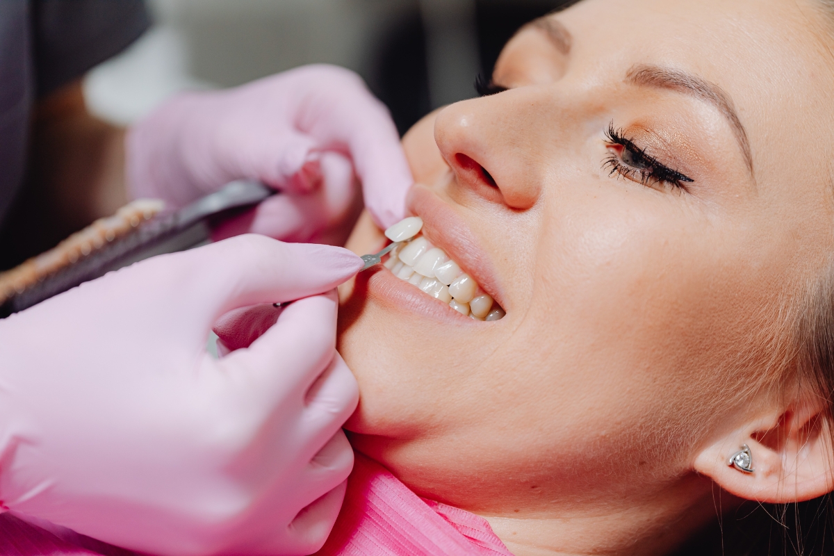 dental-veneers-in-Nashua