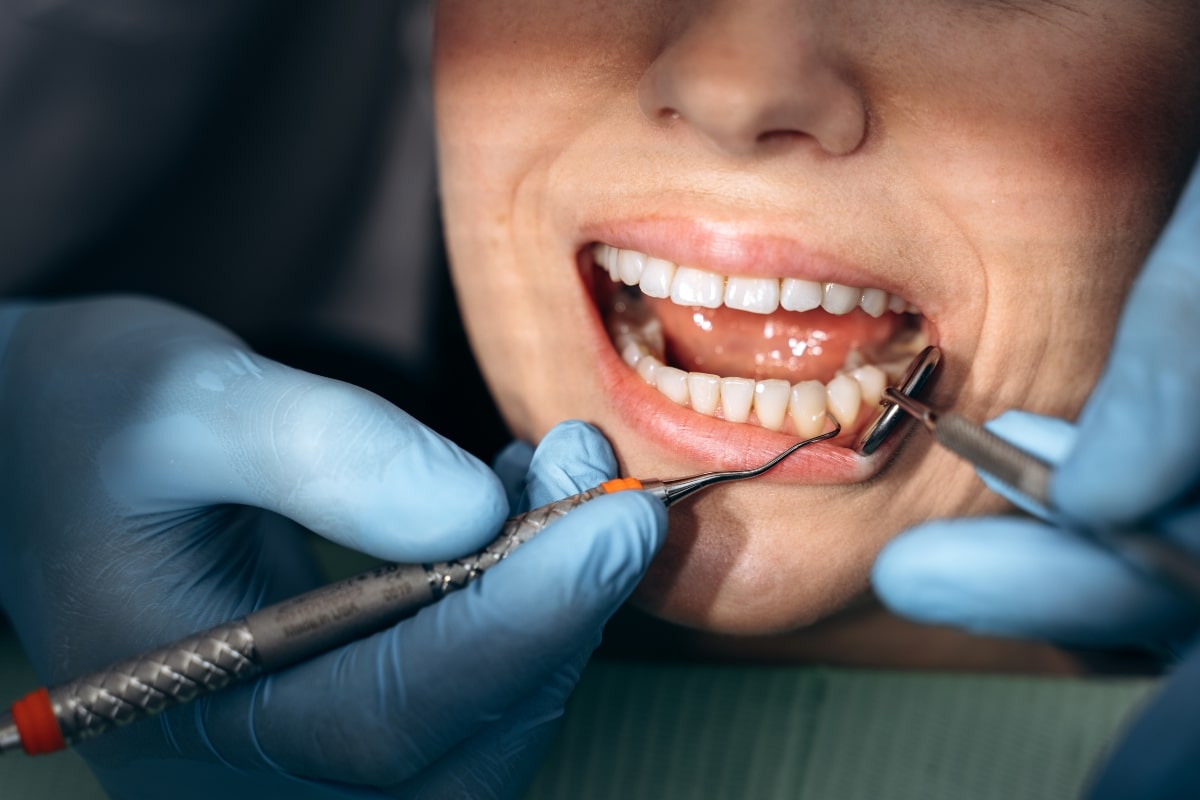dentist-in-Nashua